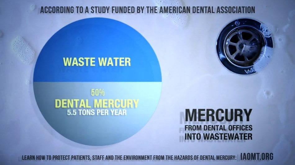 Estadísticas de agua del desperdicio de mercurio dental de la ADA