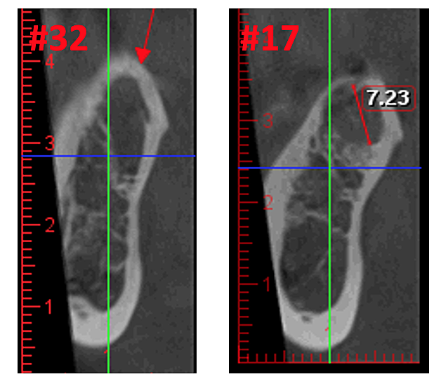 A close-up of a x-ray Description automatically generated