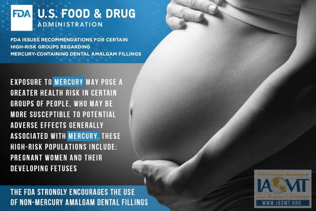 FDA upozorenja o amalgamu za trudnice