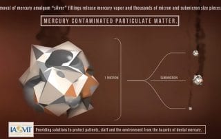 dental mercury contaminated particulate matter