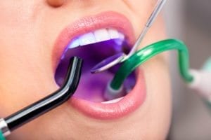 치과 제품의 불소 위험